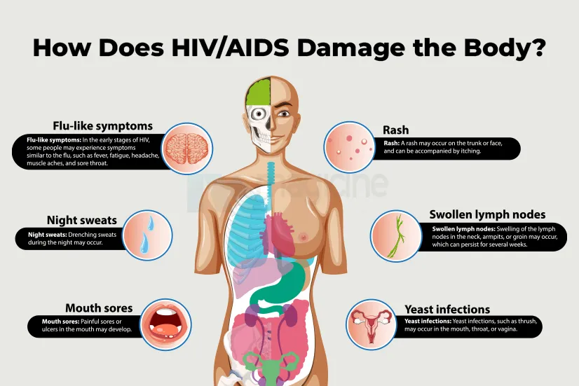 How Does HIV/AIDS Damage the Body?